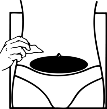 Shaded area shows recommended injection site